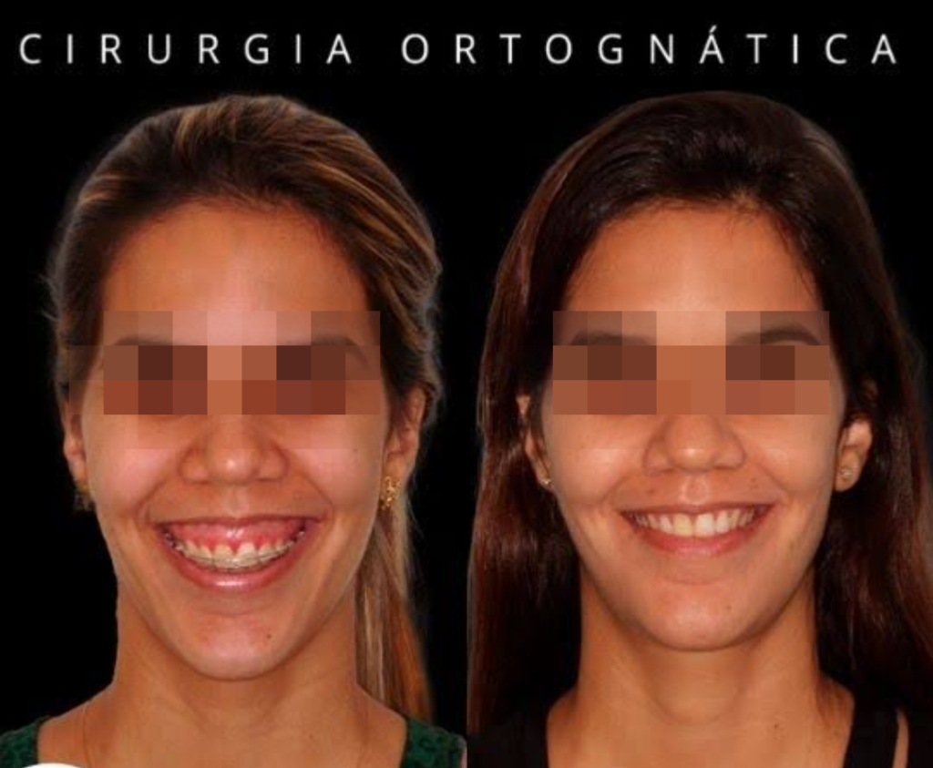 dr-danillo-dantas-dentista-salvador-bahia-cirurgia-ortognatica-